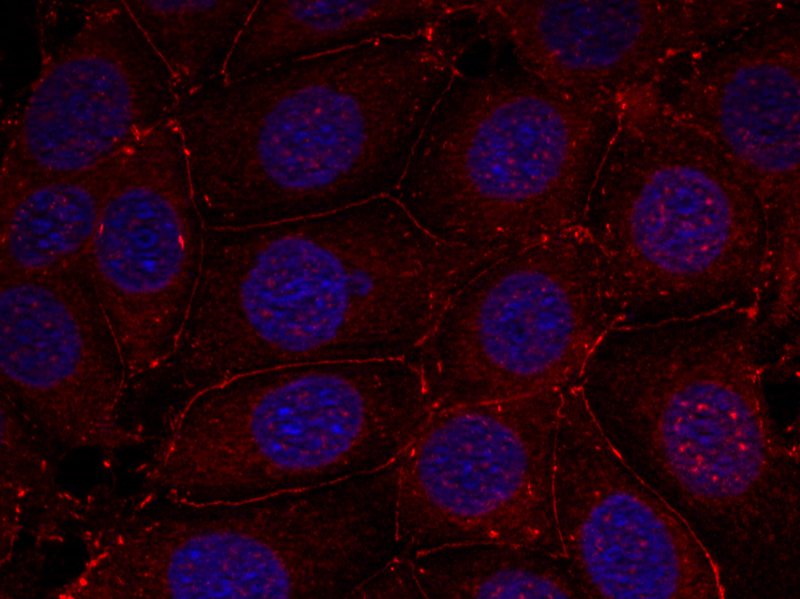 IGF-1R(Phospho-Tyr1161)