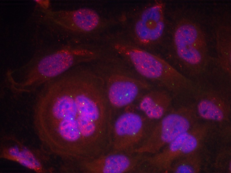 Rabbit Polyclonal Antibody to NFkB-p65(Phospho-Ser276)