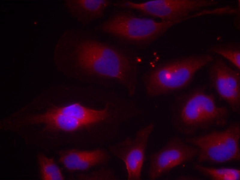 Rabbit Polyclonal Antibody to NFkB-p100(Phospho-Ser870)