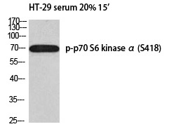 p7S6 kinase α (Phospho-Ser418)
