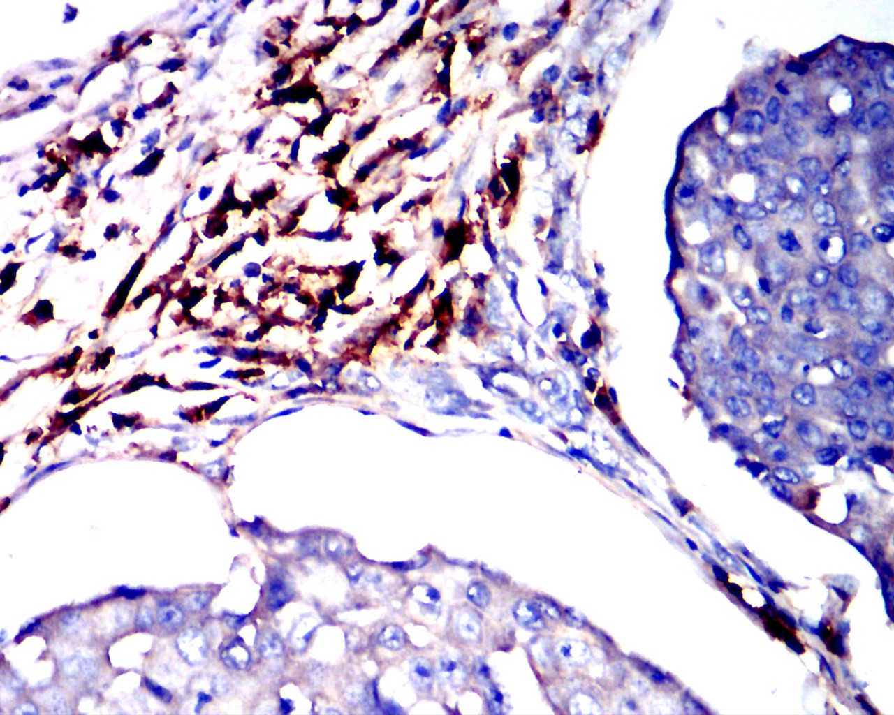 CD38
