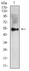Vimentin