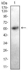 CYP3A4