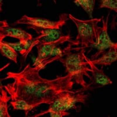 SETDB1抗体保存方法
