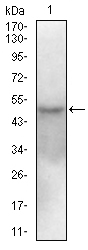 SLC16A11