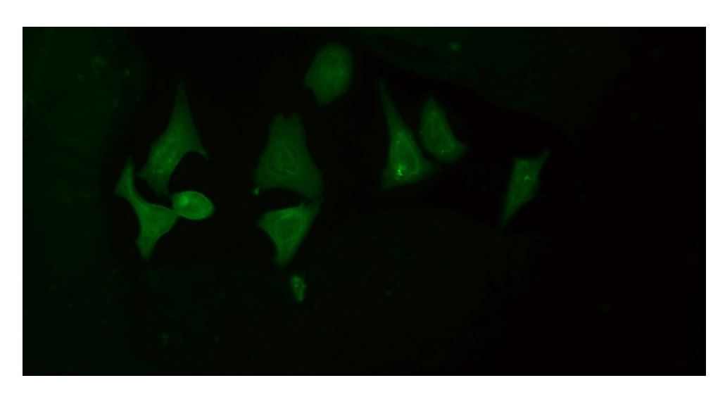 Rabbit Monoclonal to PGC1alpha/beta