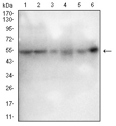 ESR1