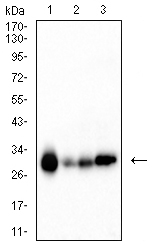 CA1