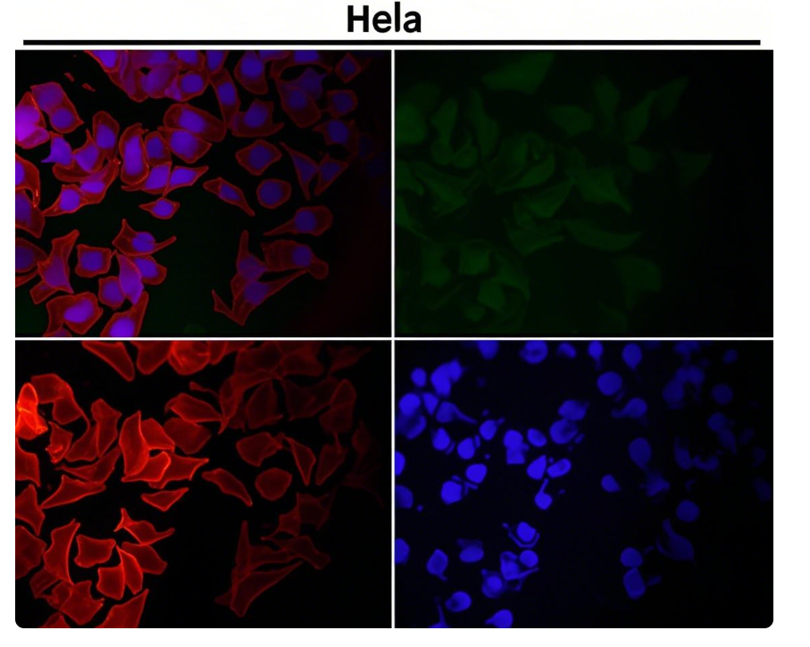Rabbit Monoclonal to ECadherin