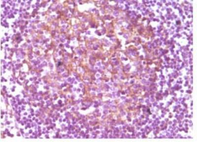 CD14抗体的临床应用价值