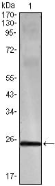 IFN-gamma