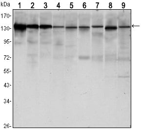 ABCC4