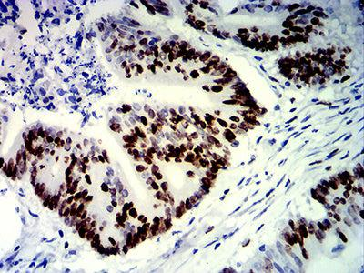 MKI67抗体免疫组化（IHC）实验步骤优化