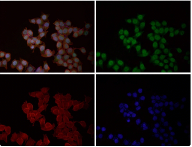 Rabbit Monoclonal to Calreticulin