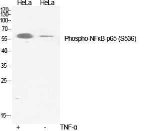 Phospho-NF-KB p65 (Ser536)