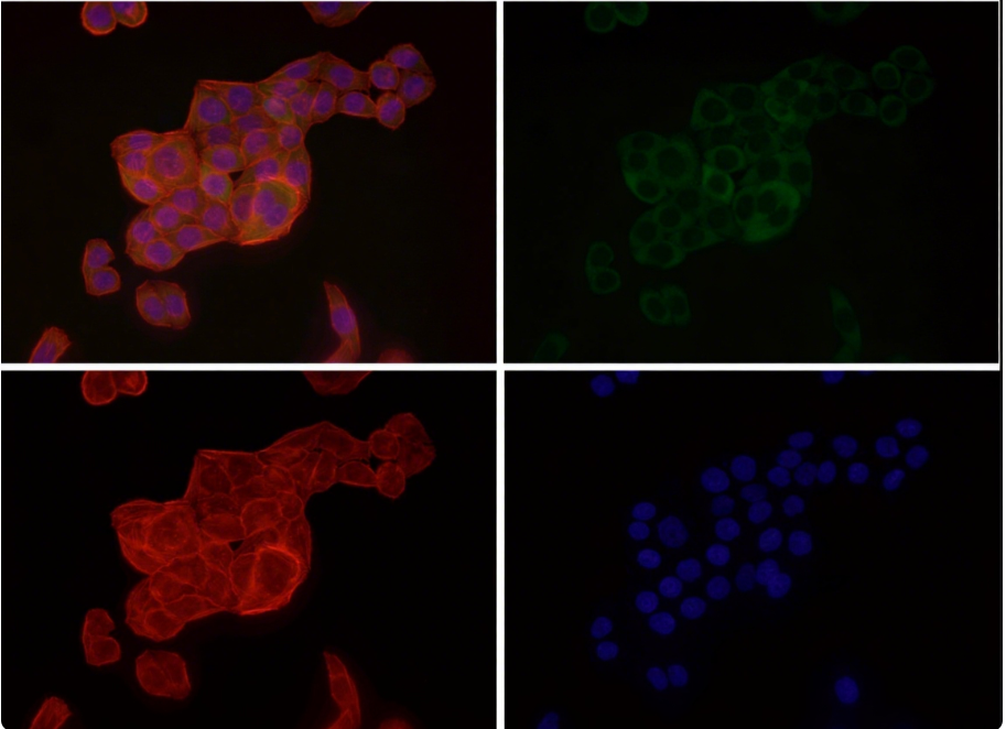 Rabbit Monoclonal to CABP