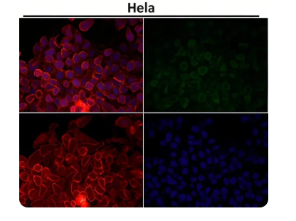 Rabbit Monoclonal to CCR2/CKR2