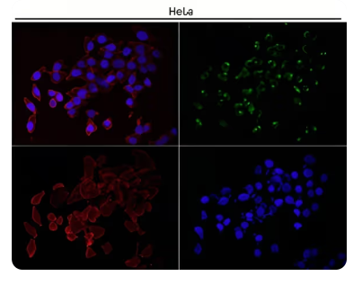 Rabbit Monoclonal to GM130