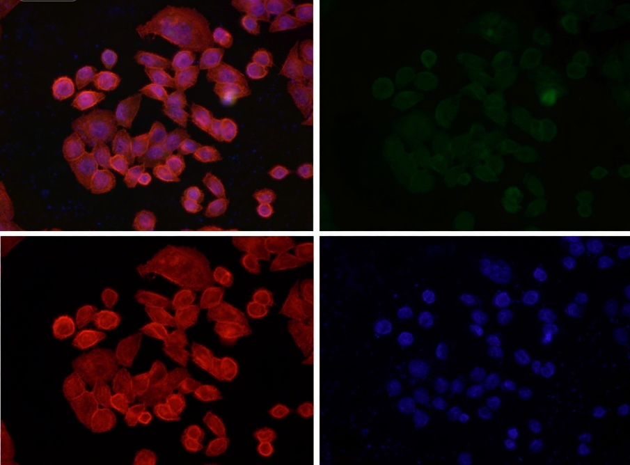 Rabbit Monoclonal to Rab9