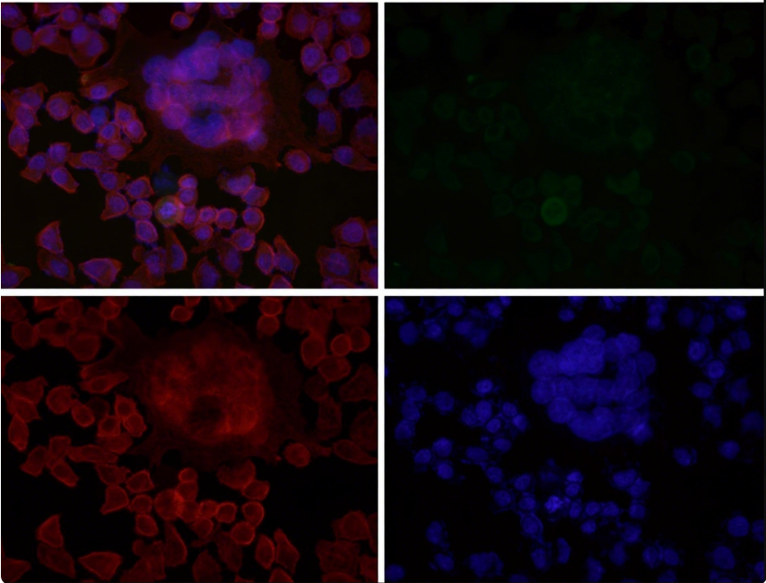 Rabbit Monoclonal to Phospho-ULK1(S556)