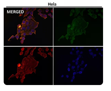 Rabbit Monoclonal to CCR9