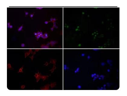 Rabbit Monoclonal to YY1