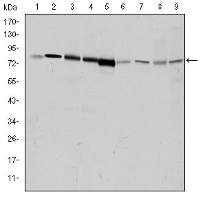 ZNF263