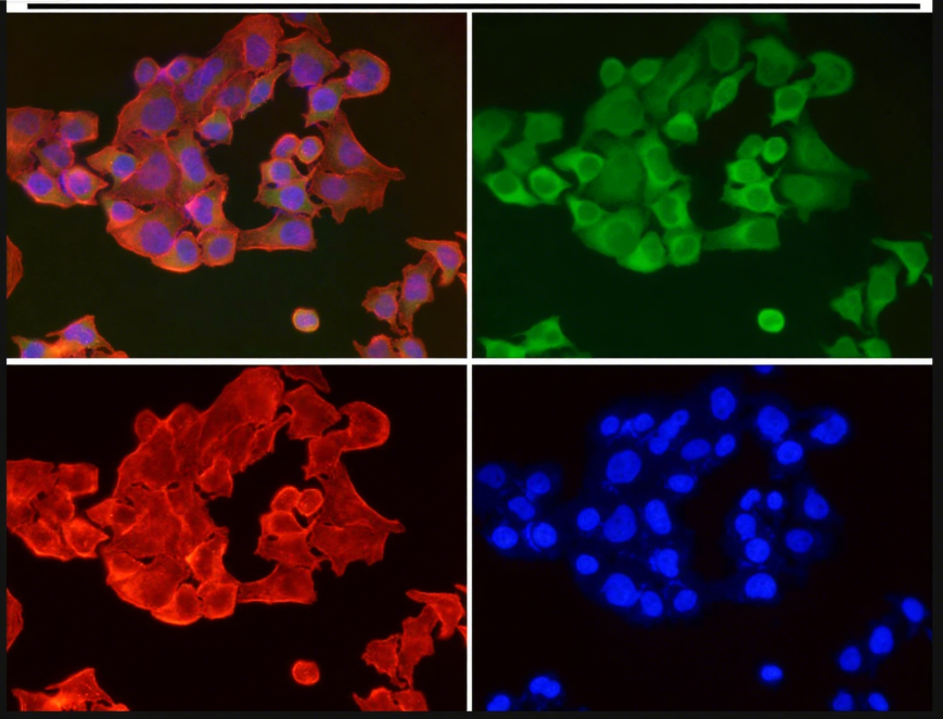 Rabbit Monoclonal to Ferritin