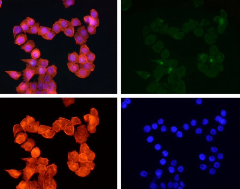 Rabbit Monoclonal to FOXO3A