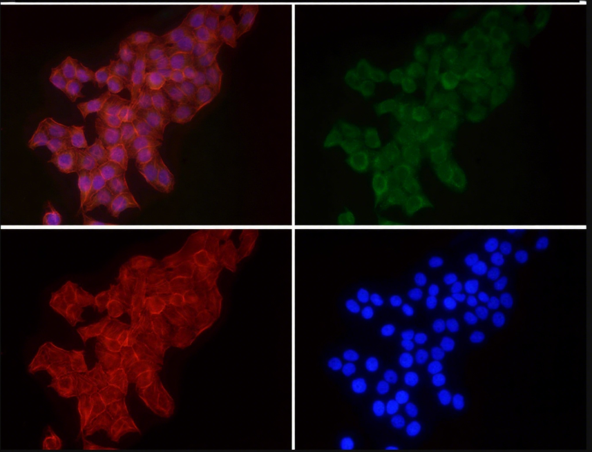 Rabbit Monoclonal to EEA1
