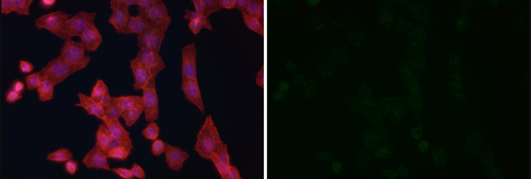 Rabbit Monoclonal to ACSS2