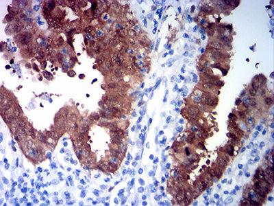 CDKN2A抗体Western Blot应用