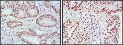MLH1抗体免疫组化阳性对照样本要求