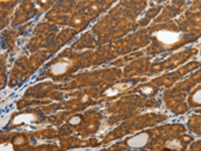 抗体定制交叉反应性高如何解决