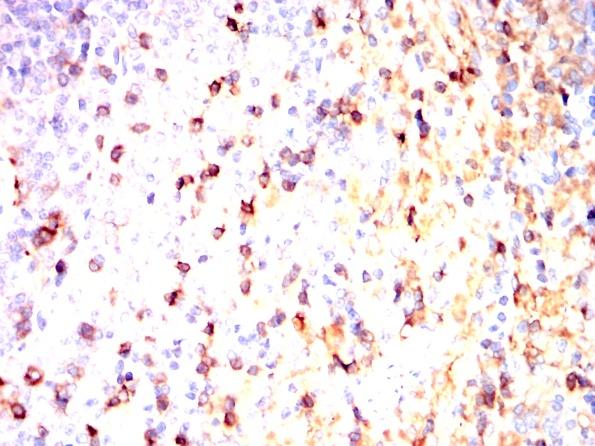 利用THY1小鼠单抗结合DAB染色对石蜡包埋大鼠脾脏进行免疫组化分析