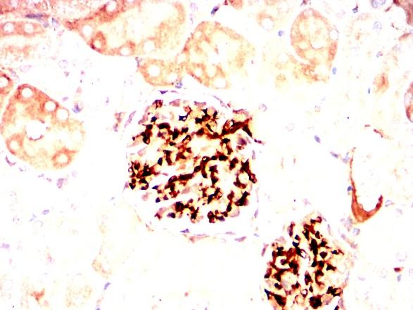 利用THY1小鼠单抗结合DAB染色对石蜡包埋大鼠肾脏的免疫组化分析