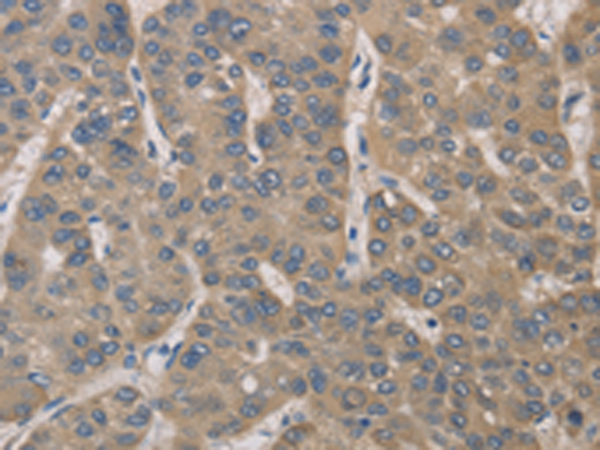 配对抗体定制方案ELISA