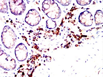 人源化MMP9抗体开发