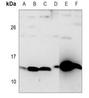SAA单抗配对定制