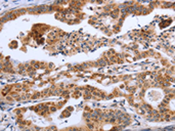 即用型免疫组化抗体