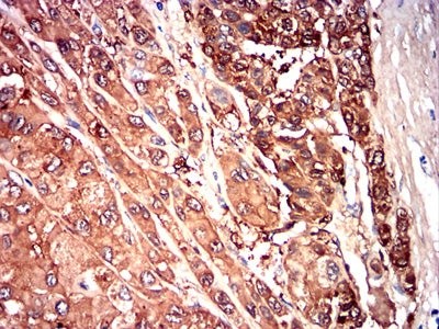 交叉反应性SAA单抗 交叉反应性SAA单抗