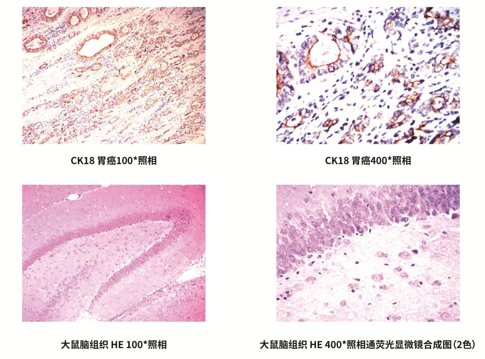 免疫组化抗体定制服务