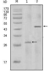 Mouse Monoclonal Antibody to IL-2